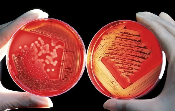 Two Petri dishes with bacterial cultures.