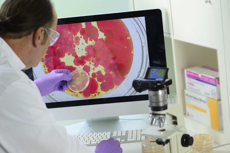 A scientist observes an experiment in a Petri dish.